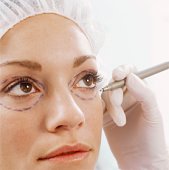 szemhéjplasztika előtti lehetőség a mezoterápia, vagy a ráncfeltöltés