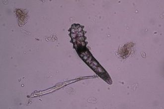 Demodex atka Demodex atka