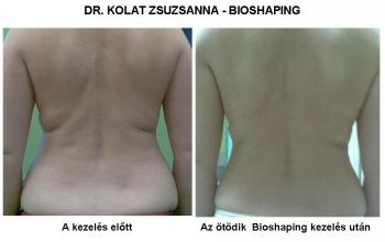 Bioshaping eredményessége/ Dr. Kolat Zsuzsanna