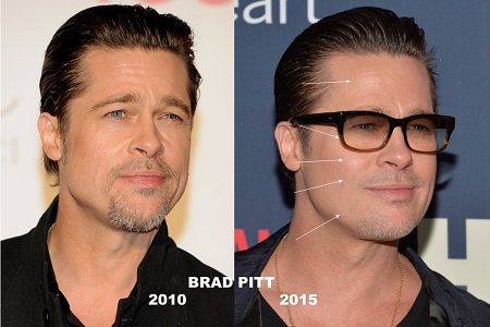 2015-re Brad Pitt intelligensebb stílust és profibb orvos-esztétikai kezeléseket választott