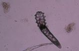 demodex atka mikroszkópikus képe