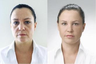 legjobb természetes anti aging arckrém