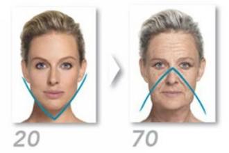 Öregedési folyamat - az arc háromszöge megfordul
