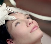 szarkalábak eltüntetése botox-injekcióval szarkalábak eltüntetése botox-injekcióval