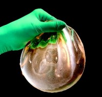 Nem alaktartó, nem kohezív géllel töltött, sima felületű= ált. alacsony minőségű implantátumot takar Nem alaktartó, nem kohezív géllel töltött, sima felületű= ált. alacsony minőségű implantátumot takar