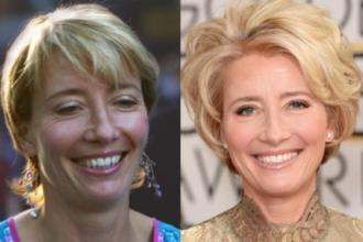 Eláruljuk hogyan fiatalodhatott meg Emma Thompson 