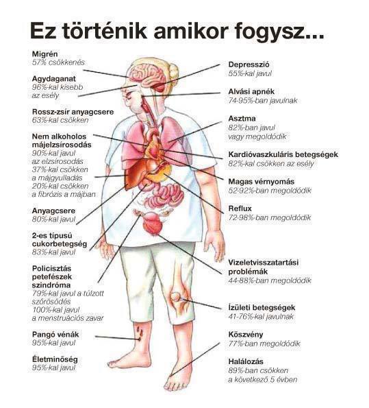 cukorbetegség hasi elhízás