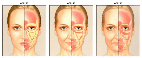 tippek az arc öregedésének elleni küzdelemhez