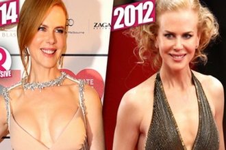 Nicole Kidman elhibázott mellplasztikája