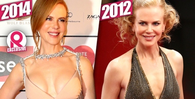 Nicole Kidman elhibázott mellplasztikája 2.kép