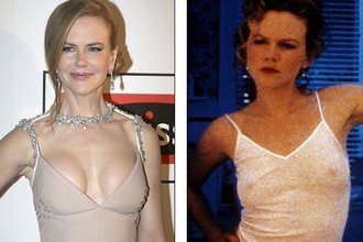 Nicole Kidman elhibázott mellplasztikája 3.kép