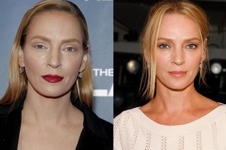 Talán Uma Thurman is plasztikáztatta az arcát?