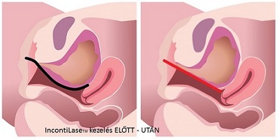 Megnyílt Budapest első esztétikai nőgyógyászat klinikája, a FEMMED Intézet 3.kép