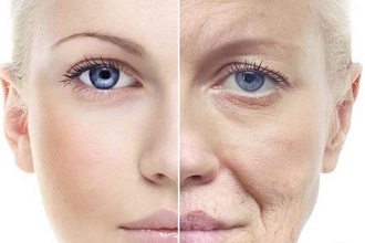 Photo-Aging, avagy az UV sugarak felelősek a bőröregedésért