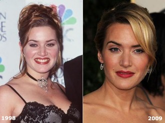 Talán csak a fogyás eredménye látható Kate Winslet-en