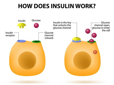Inzulinrezisztencia (IR) kialakulása, következményei és kezelési lehetősége 2.kép