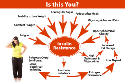 Inzulinrezisztencia: tünetek, kivizsgálás és diagnózis