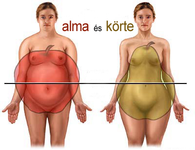 A túlsúly nem csupán esztétikai probléma, számos betegségnek az előcsarnoka 2.kép