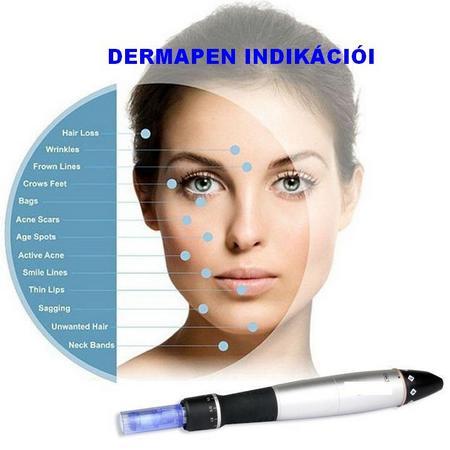 DERMAPEN vs DERMAROLLER - hasonlóságok, különbségek  5.kép