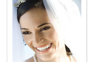 Ragyogó mosoly: fogfehérítés Menyasszonyoknak féláron 