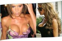 Victoria Beckham kerek implantátuma különösen feltűnő vékony testalkatán Victoria Beckham kerek implantátuma különösen feltűnő vékony testalkatán
