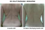 BioShaping- alakformálás