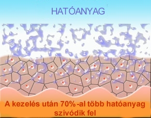 mikrodermabrázió után megnő a bőr áteresztő képessége, megújulhatnak a felületi hámsejtek