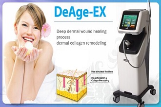 DeAge EX – a legújabb mikrotűs, frakcionált, rádiófrekvenciás eljárás (MFRF) arcfiatalításra, bőrfeszesítésre 2.kep