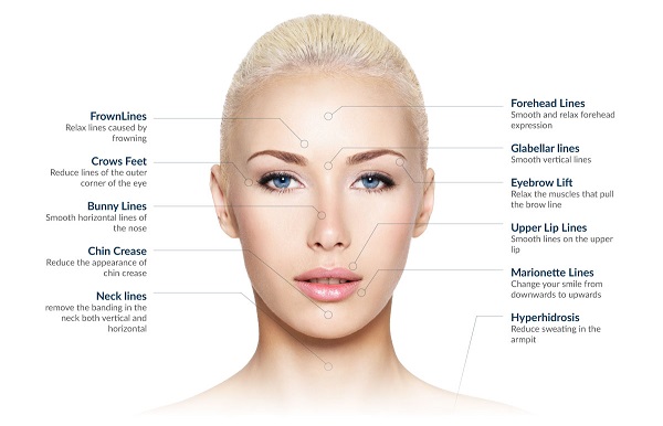 Botox-kezelés indikációs terültei