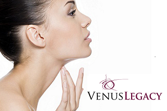 Venus Legacy 4D – A tokacsinosító és arcfeszesítő orvos-esztétikai technológia 1.kep