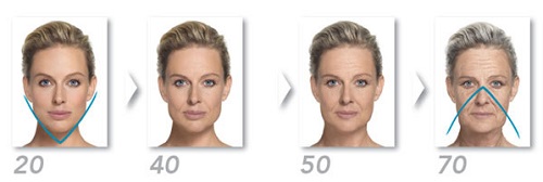 Arckontúr, arcél fiatalítás BIOstimuláló módszerrel - visszakapod a fiatalos arcvonásaidat  3.kep