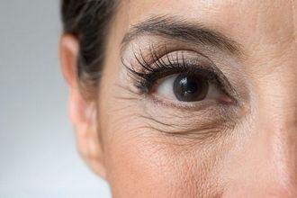anti aging szem otthoni gyógymód