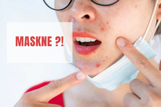 MASKNE - maszk + akne - professzionális kozmetikai megoldásai 1.kep